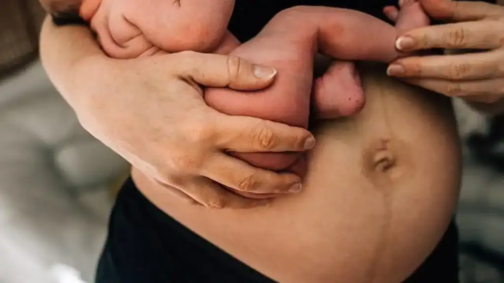 Why Is My Stomach Still Big After Pregnancy Central Milton Keynes?