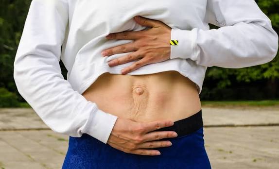When Could Diastasis Recti Be the Missing Piece of the Puzzle Central Milton Keynes?